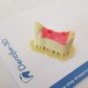 Dentifix Gingiva